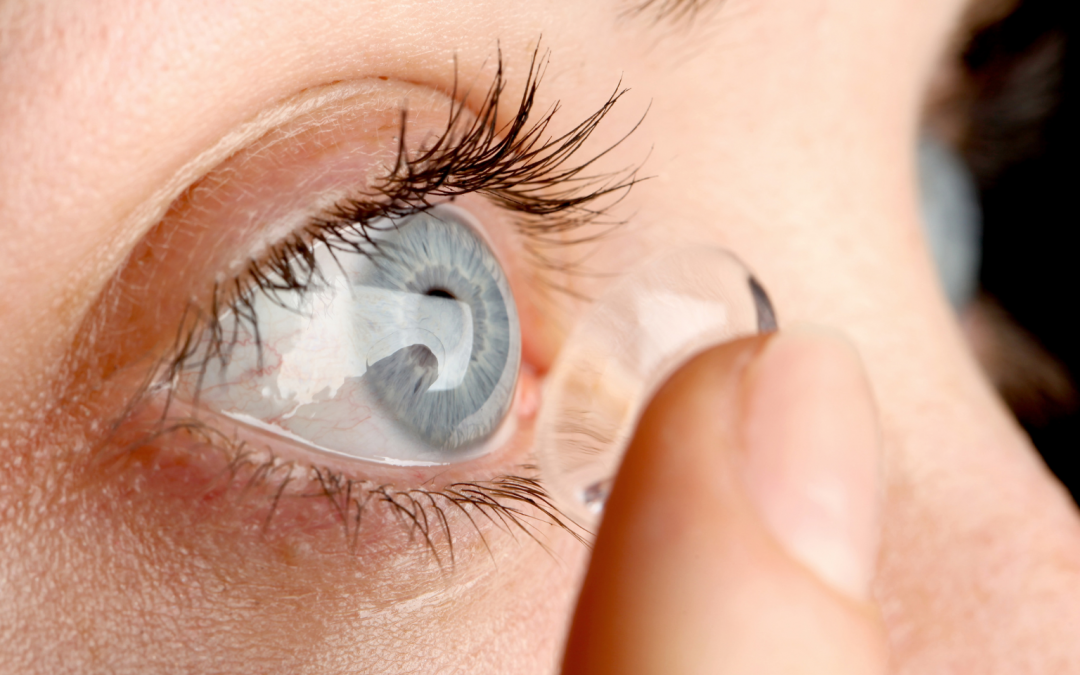 Passer aux lentilles à Caluire : tout ce que vous avez toujours voulu savoir (sans oser le demander)